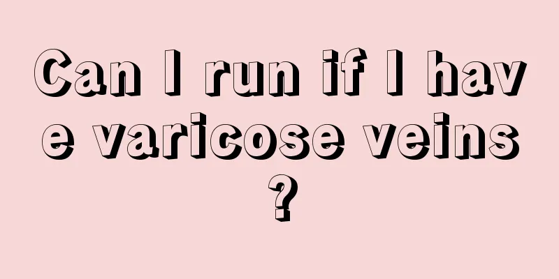 Can I run if I have varicose veins?